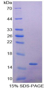 AHSP / EDRF Protein - Recombinant Alpha-Hemoglobin Stabilizing Protein By SDS-PAGE