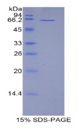 AIM / CD5L Protein - Recombinant CD5 Antigen Like Protein By SDS-PAGE