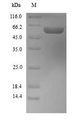 ALDH1A1 / ALDH1 Protein - (Tris-Glycine gel) Discontinuous SDS-PAGE (reduced) with 5% enrichment gel and 15% separation gel.