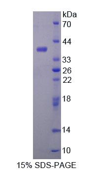 ALDH1A1 / ALDH1 Protein - Recombinant Aldehyde Dehydrogenase 1 Family, Member A1 (ALDH1A1) by SDS-PAGE