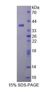 ALDH1A1 / ALDH1 Protein - Recombinant Aldehyde Dehydrogenase 1 Family, Member A1 (ALDH1A1) by SDS-PAGE