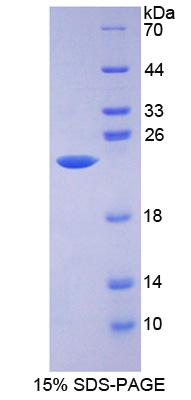 ALDH9A1 Protein - Recombinant Aldehyde Dehydrogenase 9 Family, Member A1 By SDS-PAGE
