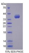 ALOX12B Protein - Recombinant Arachidonate-12-Lipoxygenase, 12R Type (ALOX12B) by SDS-PAGE