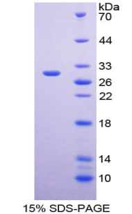 Alpha-1-Antichymotrypsin Protein - Recombinant Alpha-1-Antichymotrypsin By SDS-PAGE