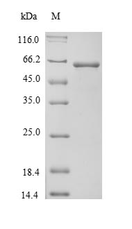 Alpha-Fetoprotein Protein - (Tris-Glycine gel) Discontinuous SDS-PAGE (reduced) with 5% enrichment gel and 15% separation gel.
