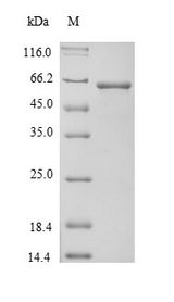 Alpha-Fetoprotein Protein - (Tris-Glycine gel) Discontinuous SDS-PAGE (reduced) with 5% enrichment gel and 15% separation gel.