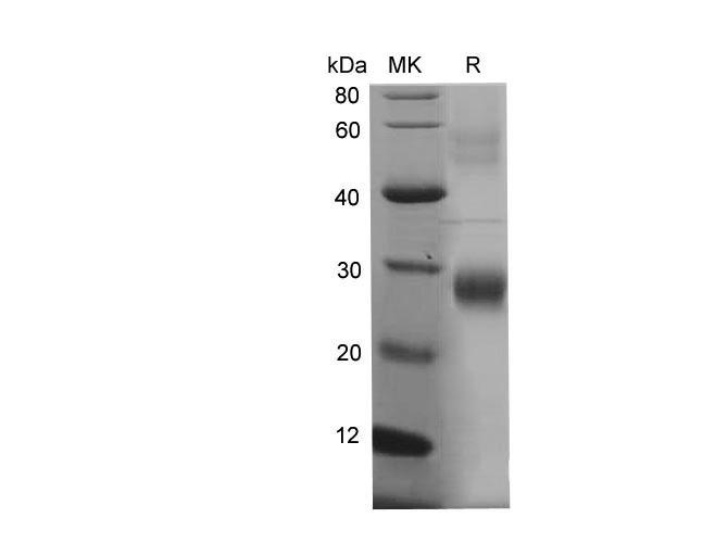 Alpha-Fetoprotein Protein - Recombinant Mouse AFP Protein (His Tag)