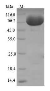 Alpha Fucosidase / FUCA1 Protein - (Tris-Glycine gel) Discontinuous SDS-PAGE (reduced) with 5% enrichment gel and 15% separation gel.