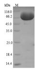 Alpha Fucosidase / FUCA1 Protein - (Tris-Glycine gel) Discontinuous SDS-PAGE (reduced) with 5% enrichment gel and 15% separation gel.