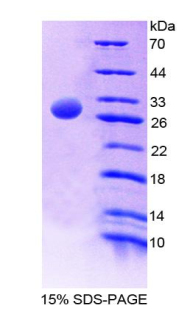 AMY2A / Pancreatic Amylase Protein - Recombinant  Amylase Alpha 2, Pancreatic By SDS-PAGE