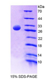 AMY2A / Pancreatic Amylase Protein - Recombinant  Amylase Alpha 2, Pancreatic By SDS-PAGE
