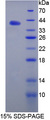 Angiostatin Protein - Recombinant Angiostatin (ANG) by SDS-PAGE