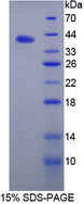 Angiostatin Protein - Recombinant Angiostatin (ANG) by SDS-PAGE