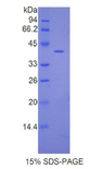 Angiotensin III Protein - Recombinant Angiotensin III By SDS-PAGE