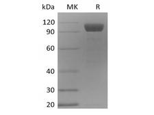 ANGPT2 / Angiopoietin-2 Protein - Recombinant Mouse Angiopoietin-2/ANG2 (C-Fc)