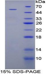 ANGPTL3 Protein - Recombinant Angiopoietin Like Protein 3 By SDS-PAGE