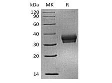 ANGPTL4 Protein - Recombinant Mouse Sialic acid-binding Ig-like lectin 15/Siglec-15/CD33L3 (C-6His)