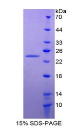 ANGPTL8 / Betatrophin Protein - Recombinant Angiopoietin Like Protein 8 By SDS-PAGE