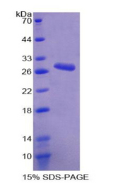 ANO1 / DOG1 / TMEM16A Protein - Recombinant Anoctamin 1 By SDS-PAGE