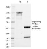 Human IgA Antibody - SDS-PAGE Analysis of Purified, BSA-Free Anti-IgA Antibody (clone HISA43). Confirmation of Integrity and Purity of the Antibody.