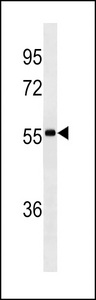Human IgA Antibody - lgA Antibody (Ascites)western blot of CEM cell line lysates (35 ug/lane). The lgA antibody detected the lgA protein (arrow).