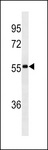 Human IgA Antibody - lgA Antibody (Ascites)western blot of CEM cell line lysates (35 ug/lane). The lgA antibody detected the lgA protein (arrow).
