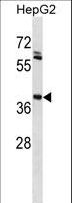 Human IgG1 Antibody - IGHG1 Antibody western blot of HepG2 cell line lysates (35 ug/lane). The IGHG1 antibody detected the IGHG1 protein (arrow).