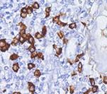 Human IgG4 Antibody - IHC of IgG4 on FFPE Tonsil tissue.