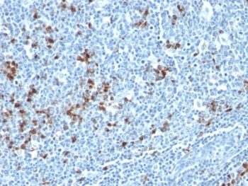 Human Kappa Light Chain Antibody - Formalin-fixed, paraffin-embedded human tonsil stained with Kappa Light Chain antibody (HP6053 + L1C1).  This image was taken for the unmodified form of this product. Other forms have not been tested.