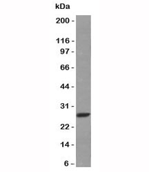 Human Kappa Light Chain Antibody - Western blot analysis of Raji cell lysate using Kappa Light Chain antibody (HP6053 + L1C1).  This image was taken for the unmodified form of this product. Other forms have not been tested.