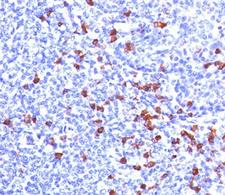 Human Kappa Light Chain Antibody - Kappa Light Chain antibody KLC709 immunohistochemistry tonsil.  This image was taken for the unmodified form of this product. Other forms have not been tested.