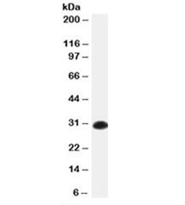 Human Kappa Light Chain Antibody - Western blot testing of human spleen lysate with anti-Kappa light chain antibody (clone KLC709).