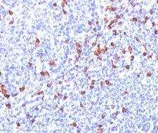 Human Kappa Light Chain Antibody - Kappa Light Chain antibody L1C1 immunohistochemistry tonsil.  This image was taken for the unmodified form of this product. Other forms have not been tested.
