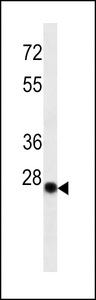 Human Kappa Light Chain Antibody - Kappa light chain Antibody western blot of human serum protein (35 ug/lane). The Kappa light chain antibody detected the Kappa light chain protein (arrow).