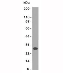 Human Lambda Light Chain Antibody - Western blot of human Intestinal lysate using Lambda Light Chain antibody (HP6054).  This image was taken for the unmodified form of this product. Other forms have not been tested.