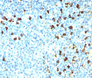Human Lambda Light Chain Antibody - Lambda Light Chain antibody ICO-106 immunohistochemistry tonsil.  This image was taken for the unmodified form of this product. Other forms have not been tested.