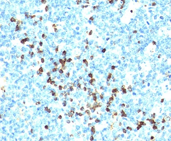 Human Lambda Light Chain Antibody - Lambda Light Chain antibody LcN-2 + ICO-106 immunohistochemistry tonsil This image was taken for the unmodified form of this product. Other forms have not been tested.