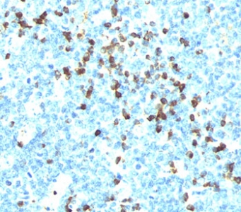 Human Lambda Light Chain Antibody - Lambda Light Chain antibody LcN-2 immunohistochemistry tonsil.  This image was taken for the unmodified form of this product. Other forms have not been tested.