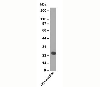 Human Lambda Light Chain Antibody - Lambda Light Chain antibody LcN-2 western blot tonsil.  This image was taken for the unmodified form of this product. Other forms have not been tested.