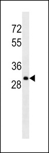 Human Lambda Light Chain Antibody - Lambda light chain Antibody western blot of Ramos cell line lysates (35 ug/lane). The Lambda light chain antibody detected the Lambda light chain protein (arrow).