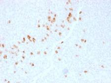 IgG4 Antibody - IHC testing of human tonsil with IgG4 antibody (clone IGHG4/1345). HIER: boil sections in 10mM Tris with 1mM EDTA, pH9 for 10-20 min followed by cooling at RT for 20 min.