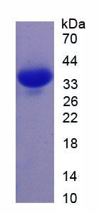 ANXA5 / Annexin V Protein - Recombinant Annexin A5 By SDS-PAGE