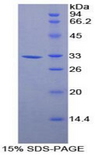 ANXA6/Annexin A6/Annexin VI Protein - Recombinant Annexin A6 By SDS-PAGE