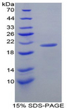 AOC1 Protein - Recombinant Diamine Oxidase By SDS-PAGE