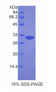 APAF1 / APAF-1 Protein - Recombinant Apoptotic Peptidase Activating Factor 1 By SDS-PAGE
