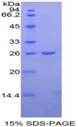 APC Protein - Recombinant Adenomatosis Polyposis Coli Protein By SDS-PAGE