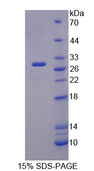 APCS / Serum Amyloid P / SAP Protein - Recombinant Serum Amyloid P Component (SAP) by SDS-PAGE