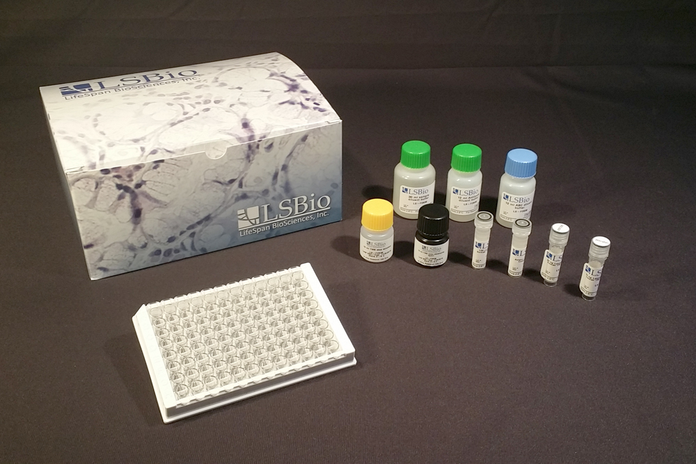 APCS / Serum Amyloid P / SAP ELISA Kit