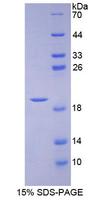 APOA1BP Protein - Recombinant Apolipoprotein A1 Binding Protein By SDS-PAGE