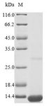 Apolipoprotein C-I Protein - (Tris-Glycine gel) Discontinuous SDS-PAGE (reduced) with 5% enrichment gel and 15% separation gel.